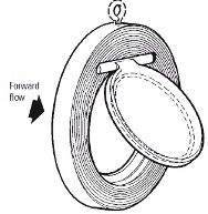 Swing Check Valve